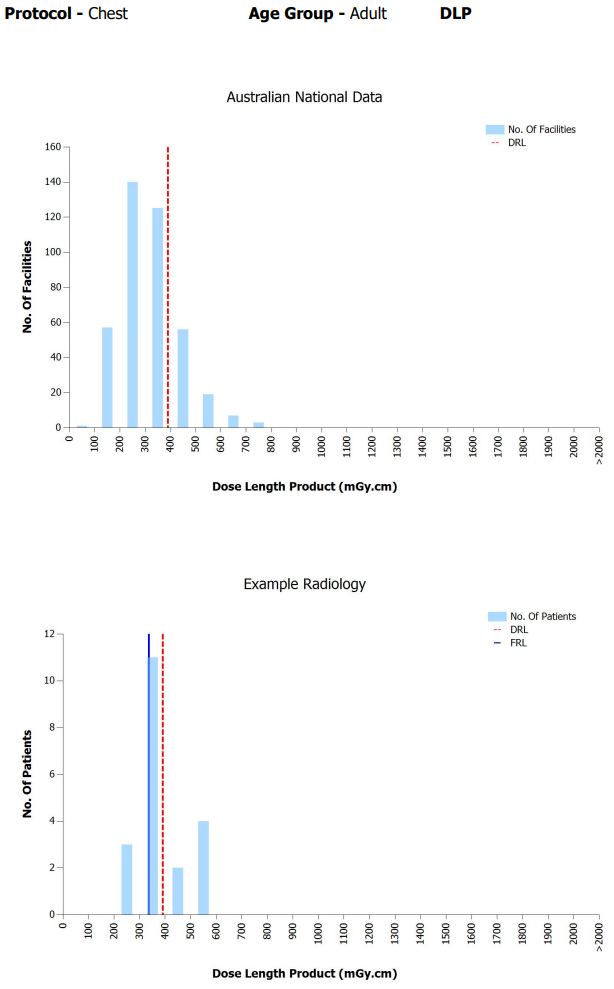 bar graphs example